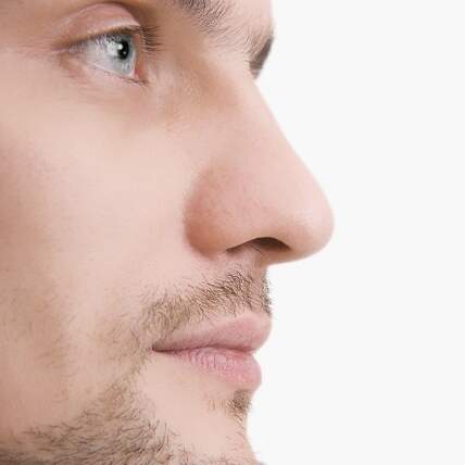 Rinoplastia masculina