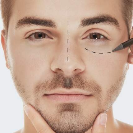 Lifting Facial Masculino