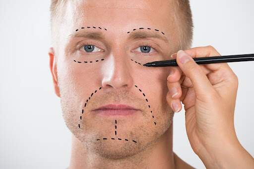 Cirurgia facial para homens rejuvenescem o visual
